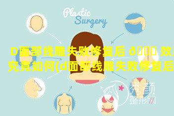 D面部线雕失败修复后 🕊 效果究竟如何(d面部线雕失败修复后效果究竟如何)